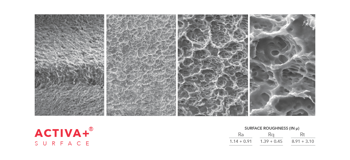 Surface